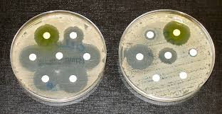 On the left, we can see spaces where bacteria aren't growing, as the antibiotics (the white circles) are preventing growth. On the right, some of the antibiotics have no effect: bacteria are still growing around the antibiotics.